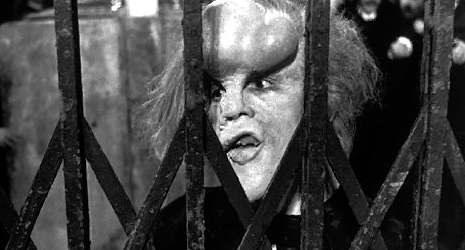 465 elephantman The Elephant Man (1980)